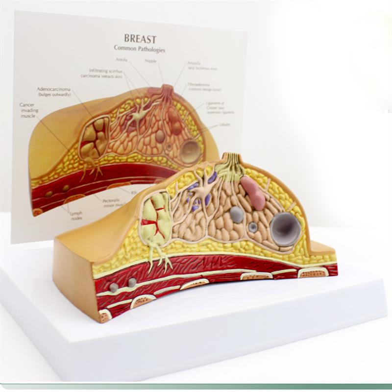 ENOVO颐诺女性乳房常见病解剖模型乳房乳腺O癌肿瘤结节模型母乳哺