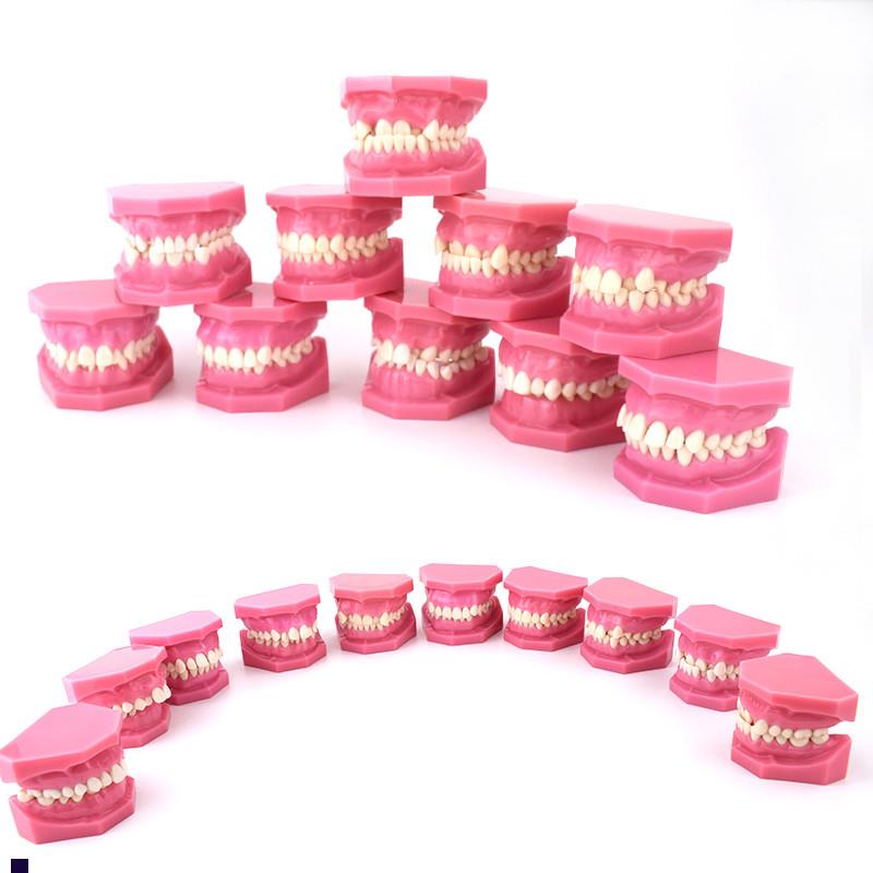 ENOVO颐诺安氏错颌分r类模型ANGEL分类错颌畸形分类演示模型口腔