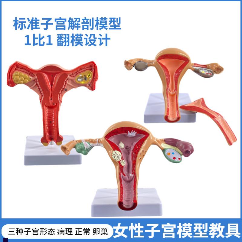 政河女性正常卵i巢病理子宫模型学校医院用生殖器官解剖教学教具