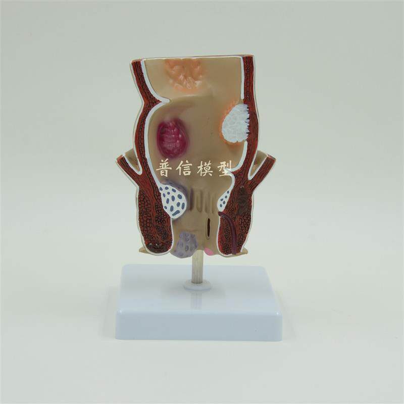 普信仿真人体直肠结肠演示模型 教用医用L肛肠科教学沟通用具解剖