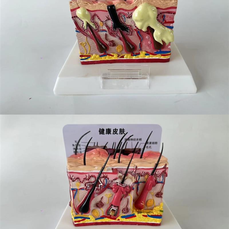 狗皮肤解剖模型痤疮表皮s毛囊解剖真皮医学美容整形立体皮肤教具