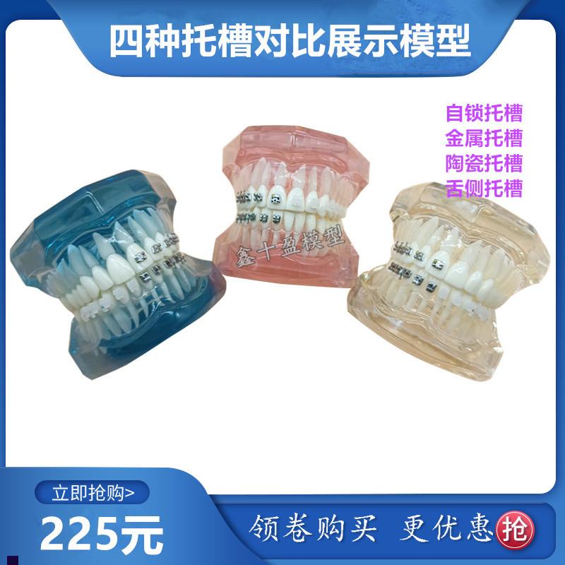牙科正畸模型g4种托槽对比模型金属陶瓷舌侧自锁托槽示范模型