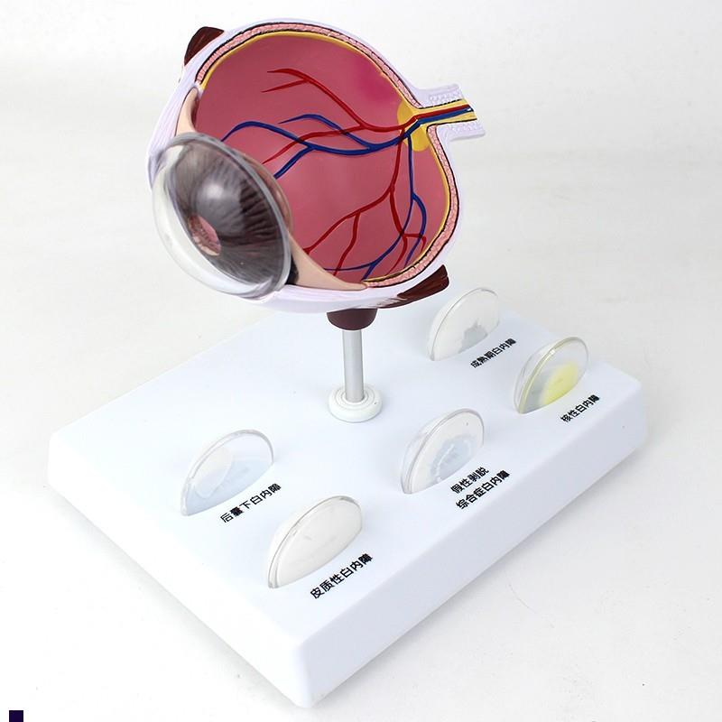 ENOVO颐诺人体眼球白内障眼疾病瞳J孔眼球体眼珠晶体医学教具