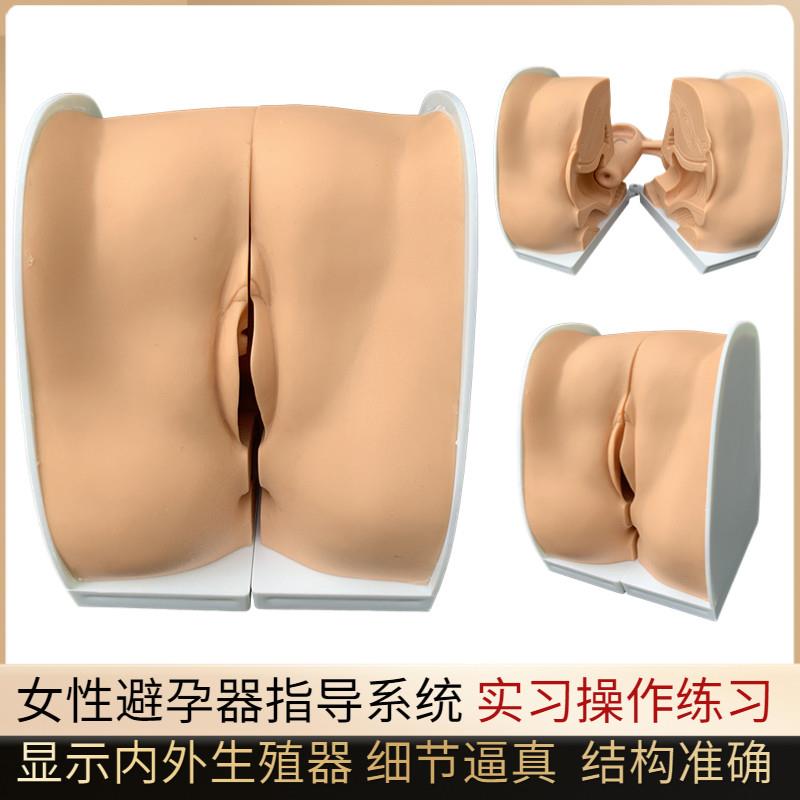 避孕指导模型女性避孕模型妇科检查模型教学培训W计划生育专用