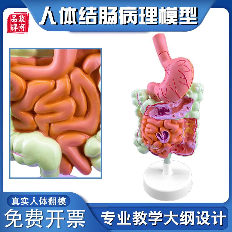 政河结肠病理演示人体器官结构解B剖模型十二指肠胃系统内脏构造