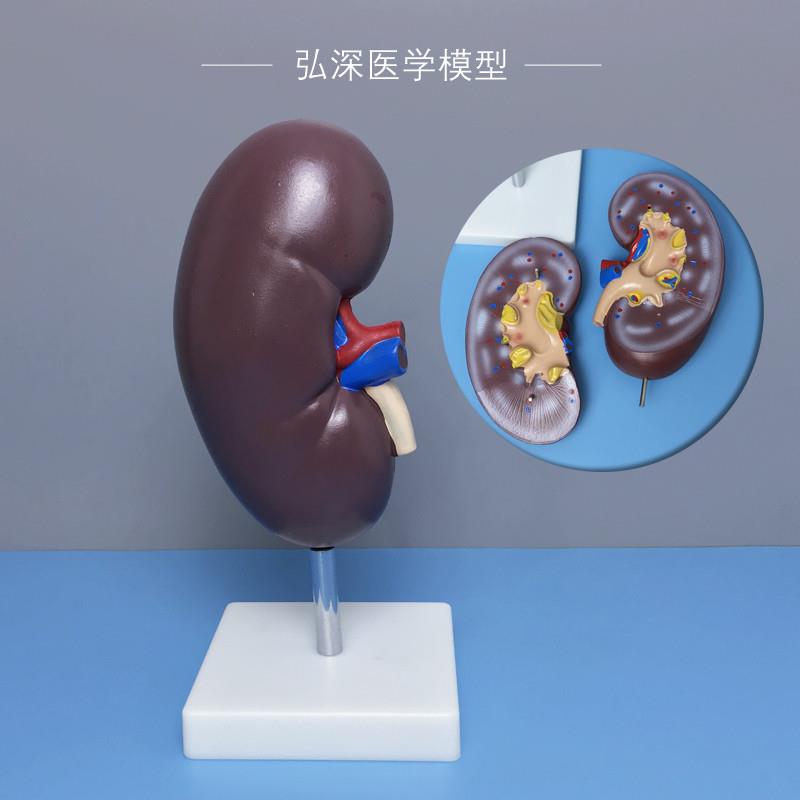 人体肾脏解e剖模型肾器官剖面内脏结构放大泌尿系统医学生教学模