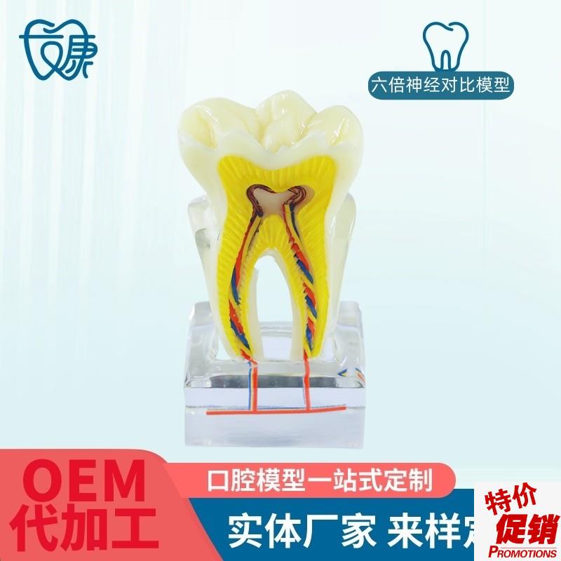 牙科口腔6倍神经线教学模型蛀牙龋D坏发展演示成人病理模型牙展示