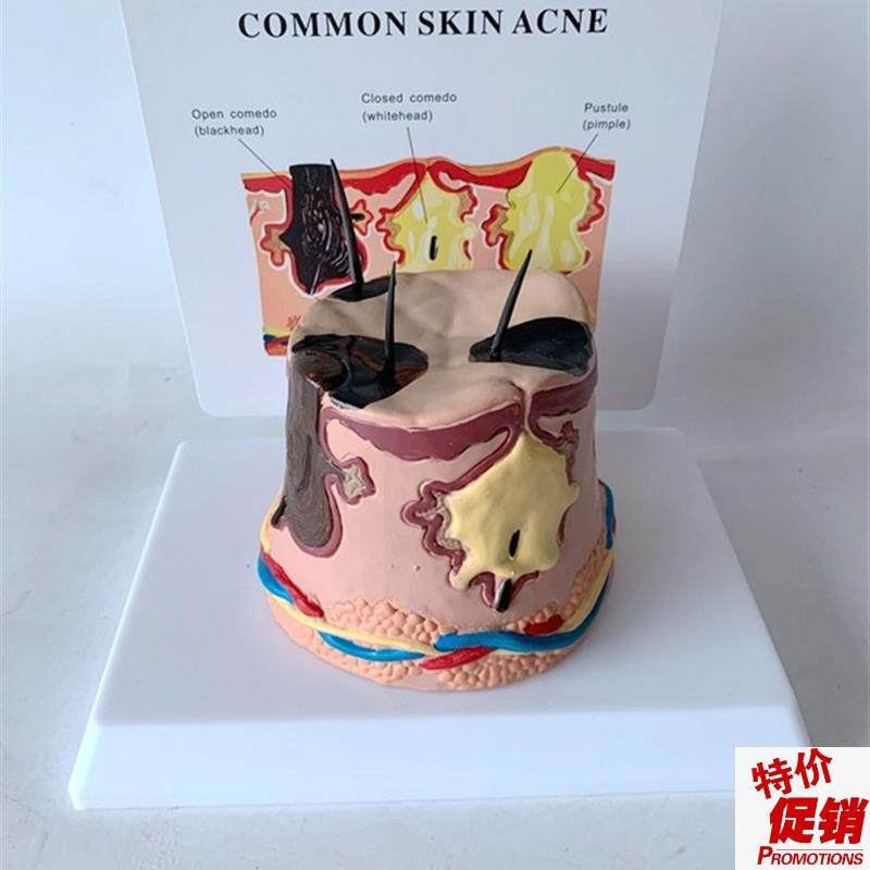 放大皮肤结构解i剖模型组织层次皮肤构造模型具微整形缝合美容教