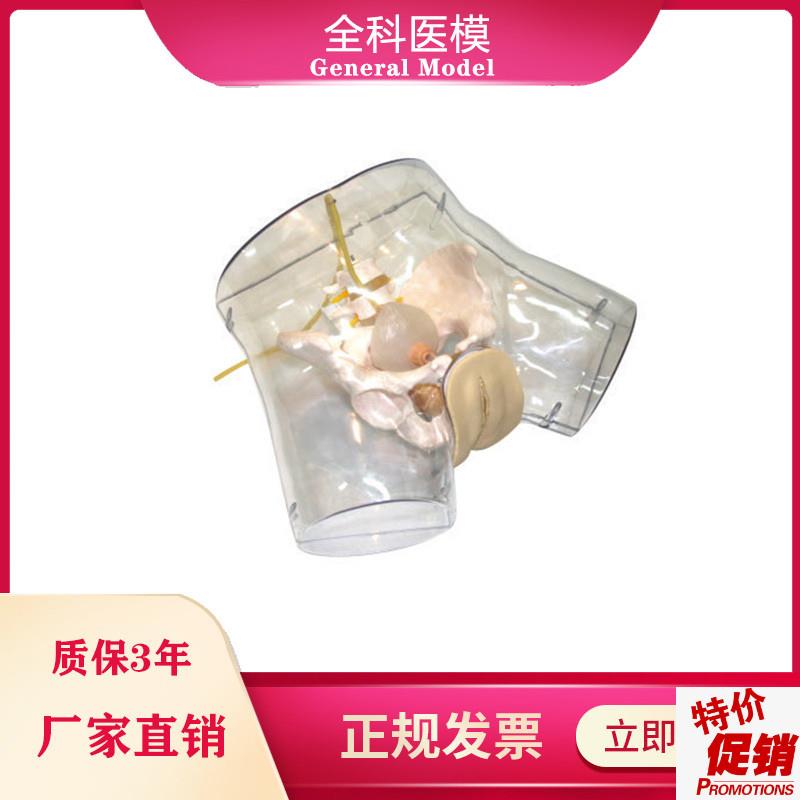 透明刮宫模型护理导尿人工流产妇科阴部内部解剖观察模型VGM/FT32
