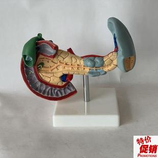 十二指肠胆囊胰腺脾脏人体u内脏标本教学肝门静脉腹腔干病理医药