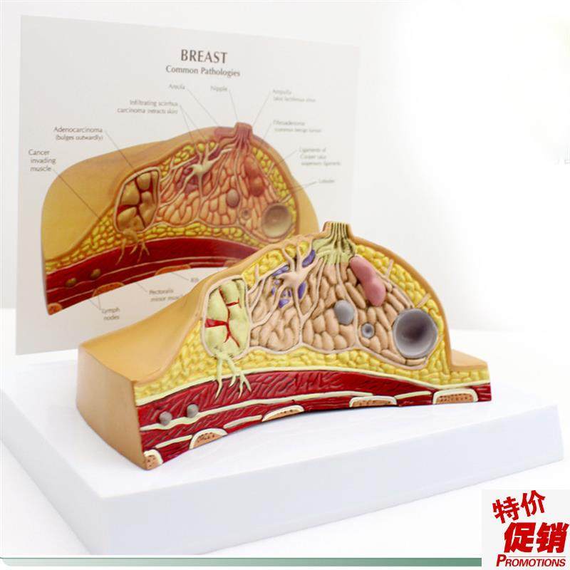 ENOVO颐诺女性乳房常见病解剖模型乳房乳腺癌Q肿瘤结节模型母乳哺,文具电教/文化用品/商务用品,教学标本/模型,淘宝优惠券,粉丝福利购,淘宝优惠卷