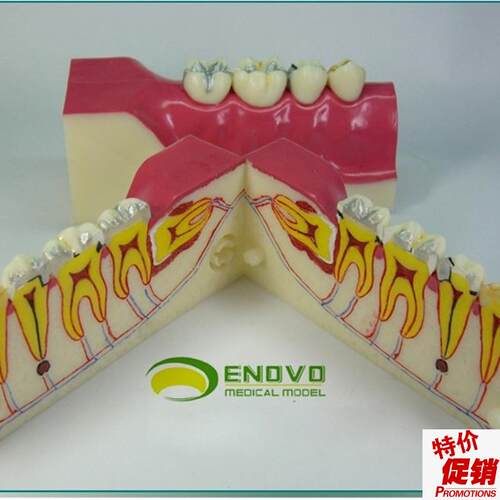 ENOVO颐诺右下后牙组织分解模型牙齿解K剖牙列模型口腔齿科科教学