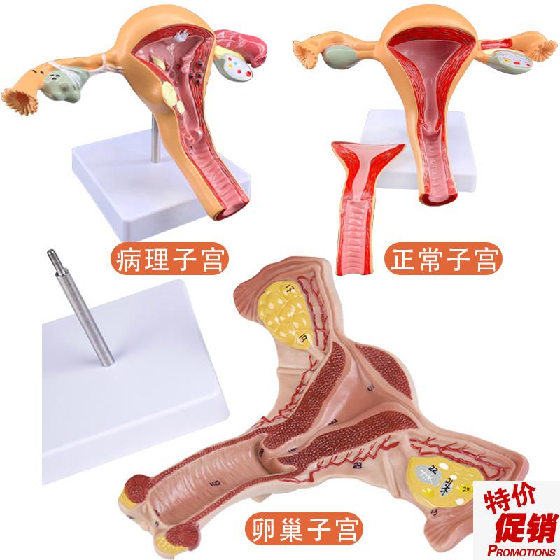 人体模型女性生殖子宫模型阴道卵巢模型教学模具S子宫病理演示模