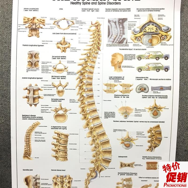 医院人体解剖图挂图人体器官结构图人体脊柱脊椎骨Y颈椎图挂图