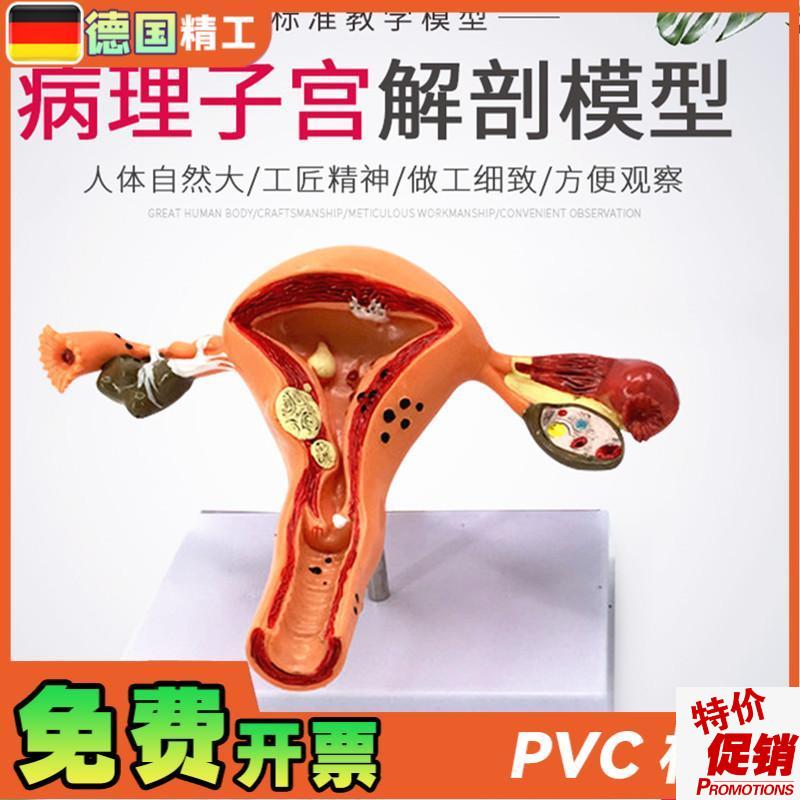 女性大子宫e模型放大模型女性生殖解剖模型计划生育示教模型