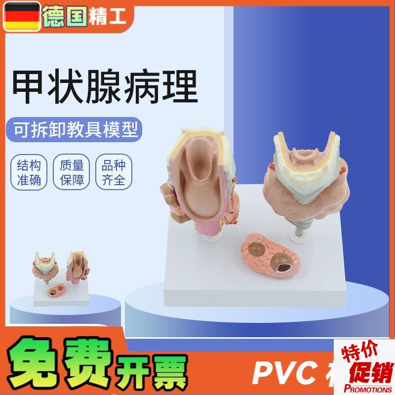 德国】甲状腺病理模型喉头解剖模型教学用P解剖甲状腺病理模具