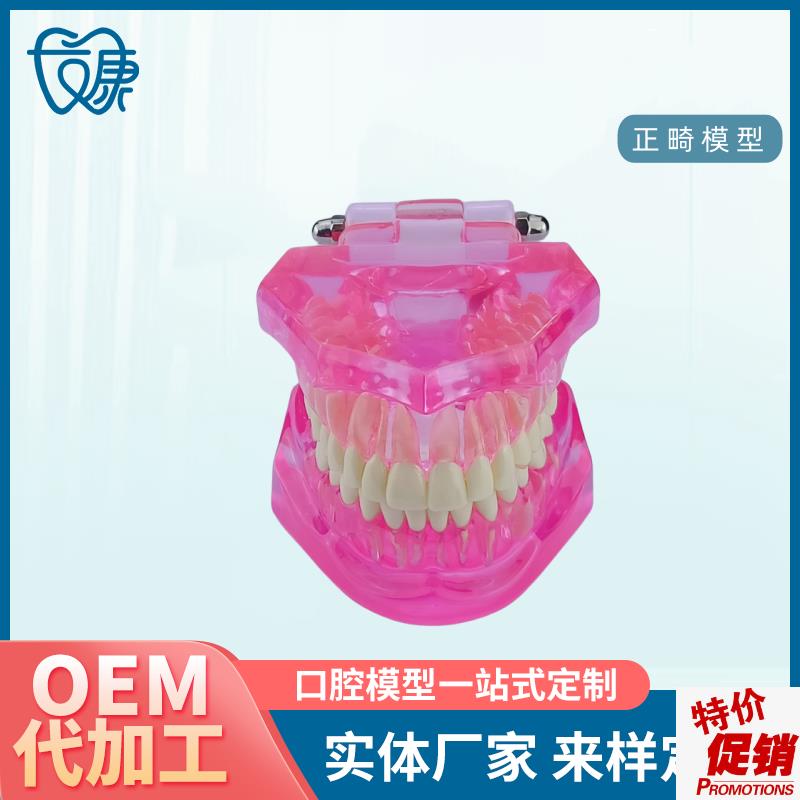 牙齿模型病理修复可拆卸正畸口腔病理I牙模型牙科医患活动沟通