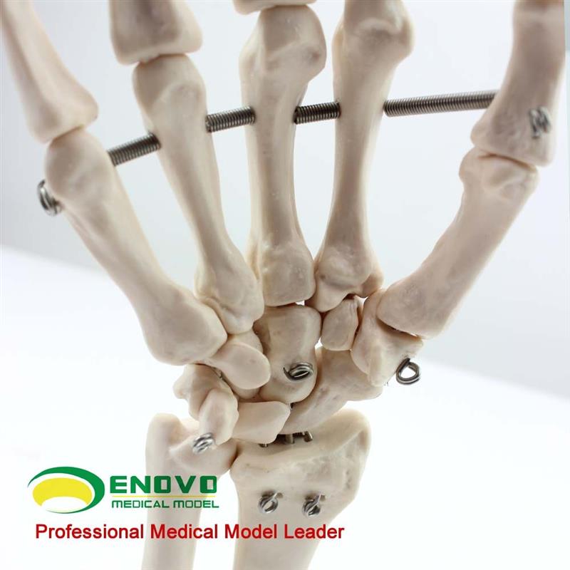 ENOVOd颐诺医学人体手关节模型手骨尺骨桡骨模型人体骨骼手足外科