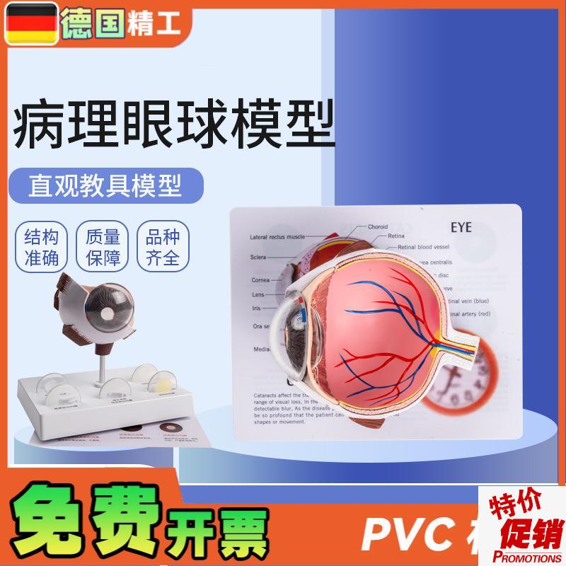 德国】病理眼球模型眼球s模型角膜病变眼球模型医学教学教材模