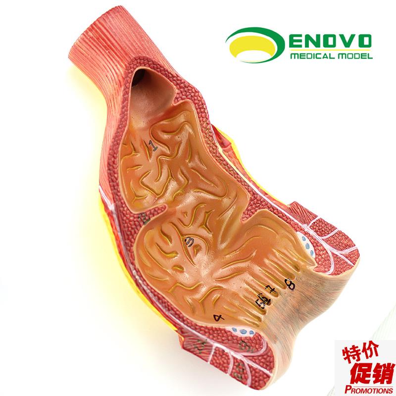 ENOVO正品医用人体直肠肛x管肛门解剖结构模型肛肠科外科消化系统