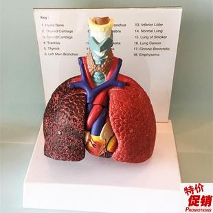 人体喉心肺肺脏i模型心脏喉管气管淋巴结医用胸外科教学厂家直销