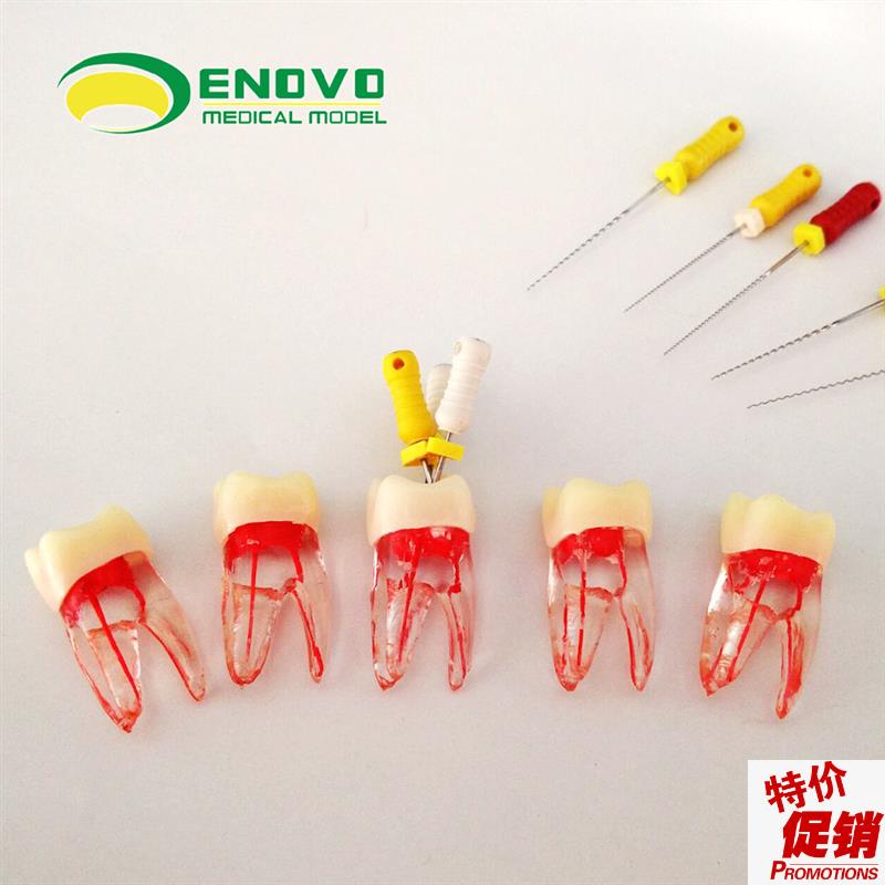 ENOVO正品根管仿真离体RCT根管教学练习牙体牙V髓根管器械操作