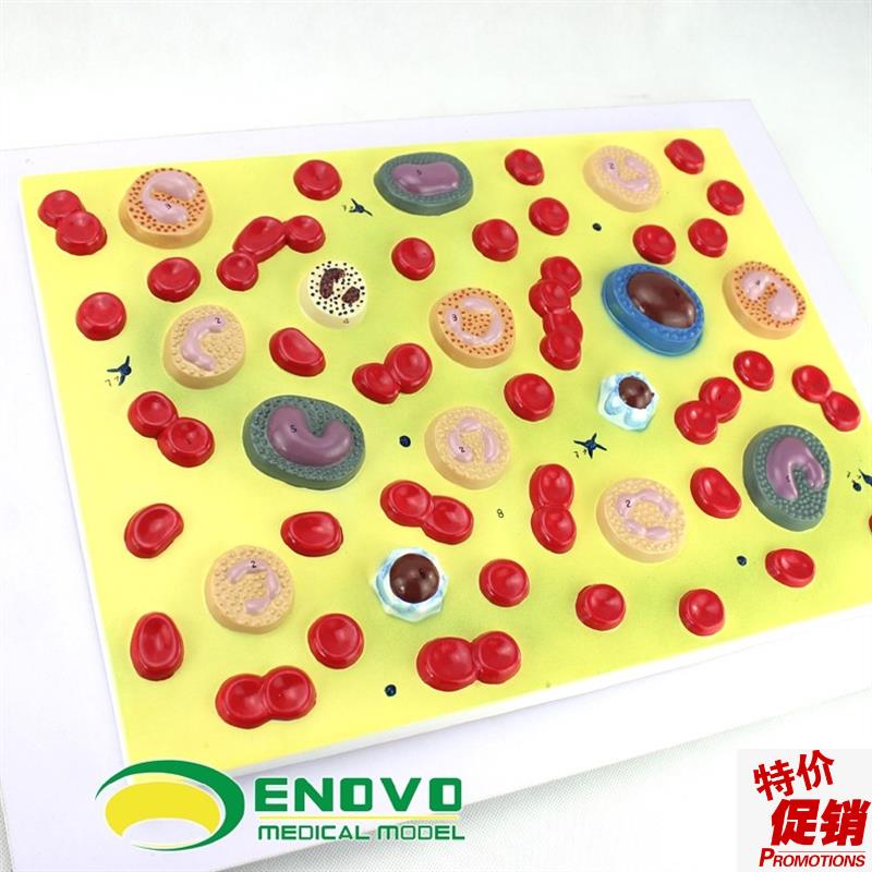 ENOVO颐诺医学人体血细胞放大模C型血液病学内科病理生理教学模型