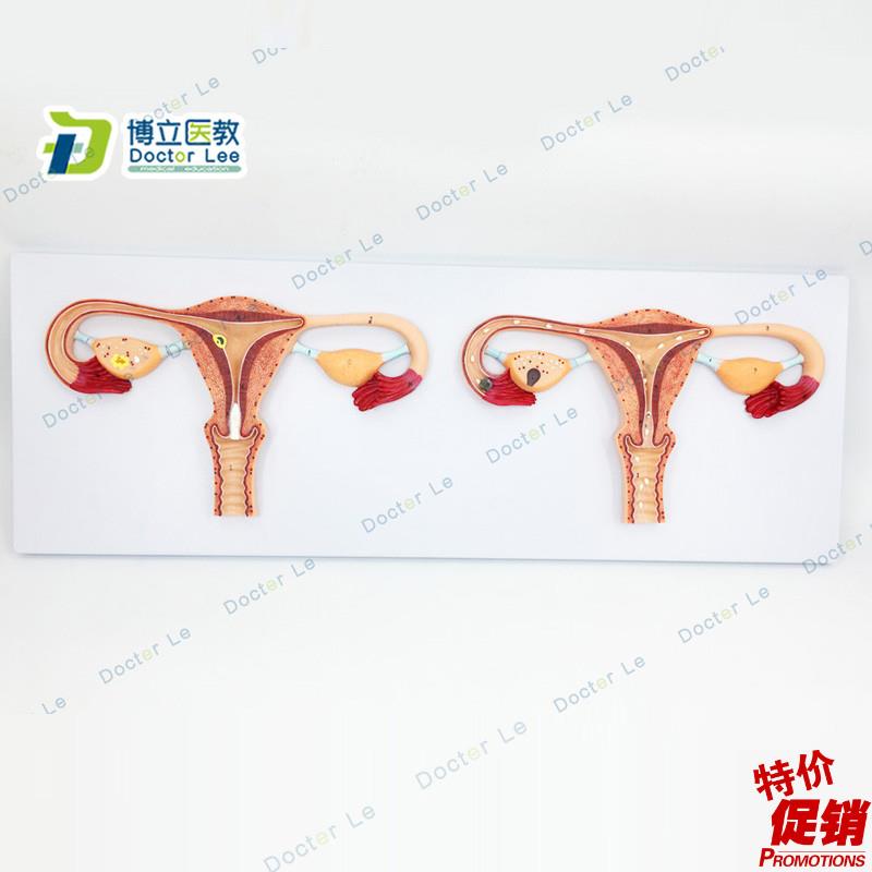 厂家正品直销卵子受精过程v放大模型女性卵子受精及卵子发育输送