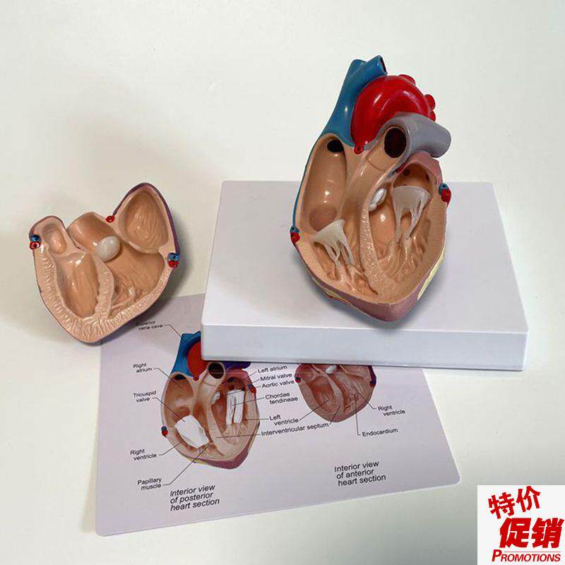 瑞泰模型人体心脏二尖瓣主动脉冠状动脉心室彩超影像W教学模具仿