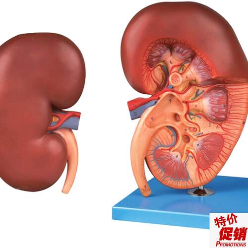 肾脏解剖放大模型/解剖模型Y14005