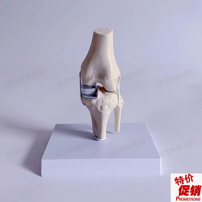 膝关节单髁置换人工膝盖半月板软骨假体替换O临床骨科手术演示操