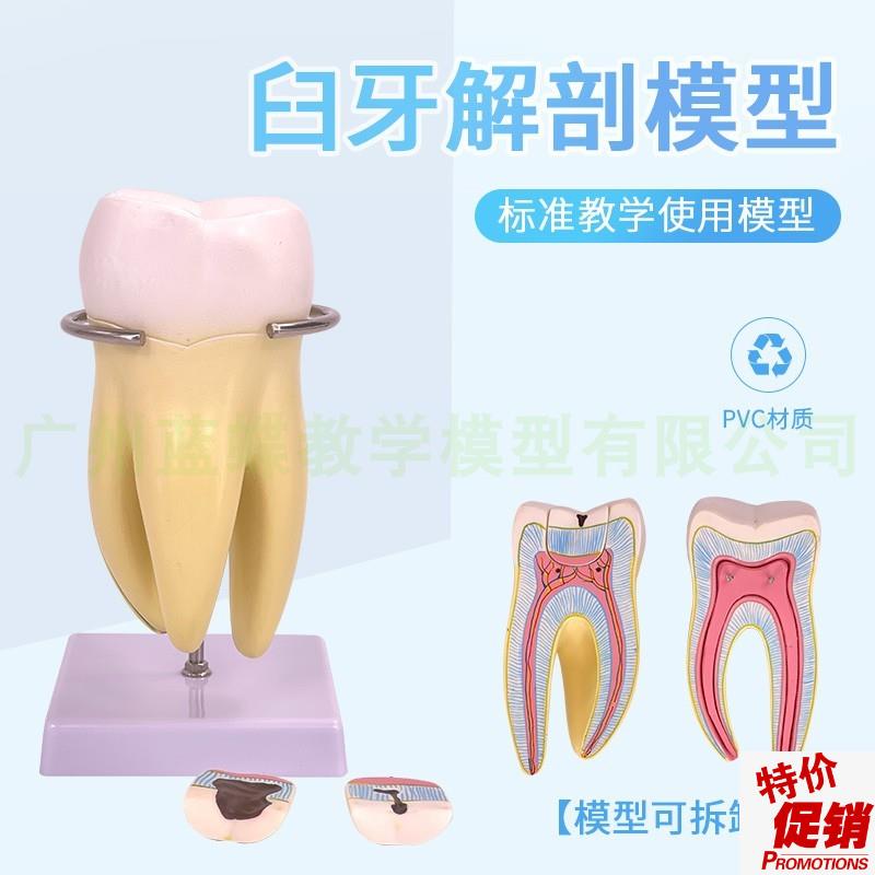 磨牙解剖放大模型人体大磨牙模型6件套口N腔牙教具磨牙牙齿模型