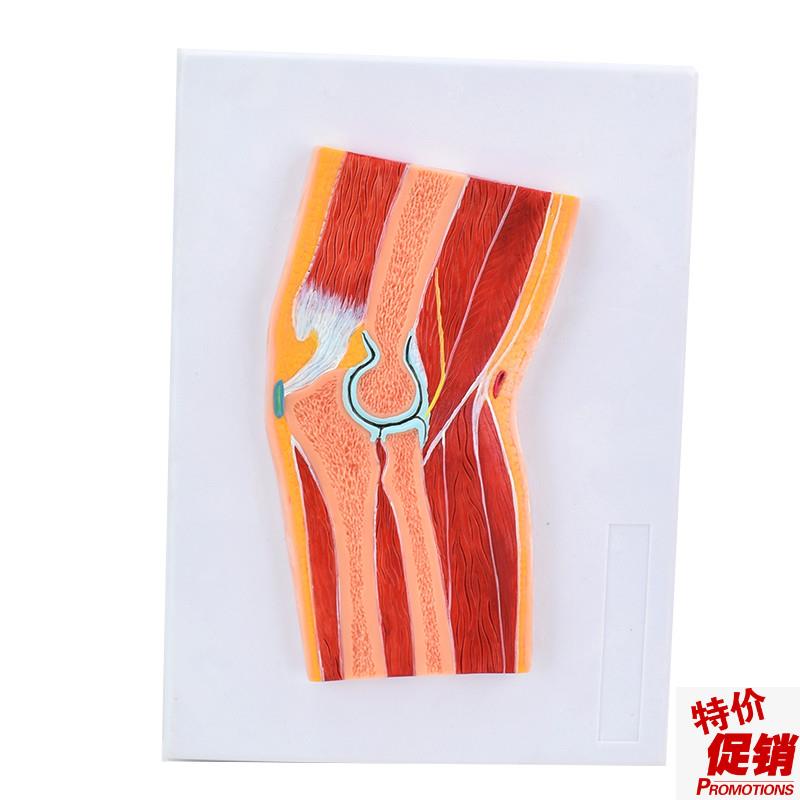 ENOVO颐诺医学解剖肘关节骨骼肌肉模型肘关节剖面S肘关节构造MRI