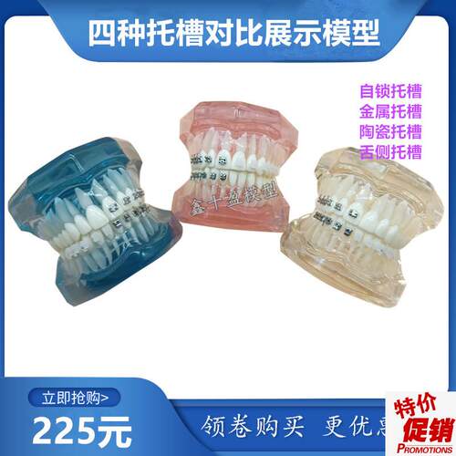 牙科正畸模型4种l托槽对比模型金属陶瓷舌侧自锁托槽示范模型