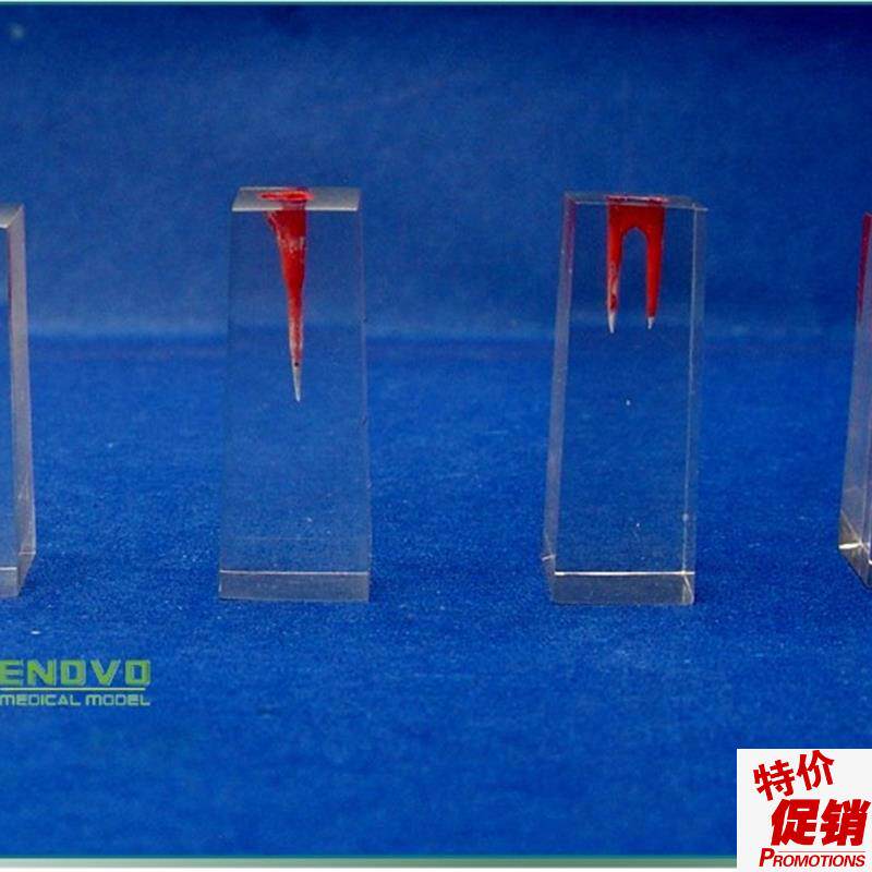 颐诺正品口腔科实习用根管模型牙体牙髓学根管充填.和窝洞制备