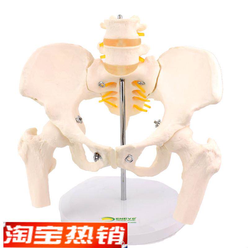 ENOVO颐诺女性骨盆康复矫正模型骨盆前倾后倾R侧倾左右旋转髋骨盆