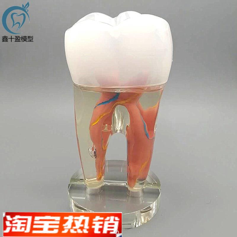 10倍牙齿模型牙形摆台口腔牙科D教学演示模型牙医诊所装饰礼品