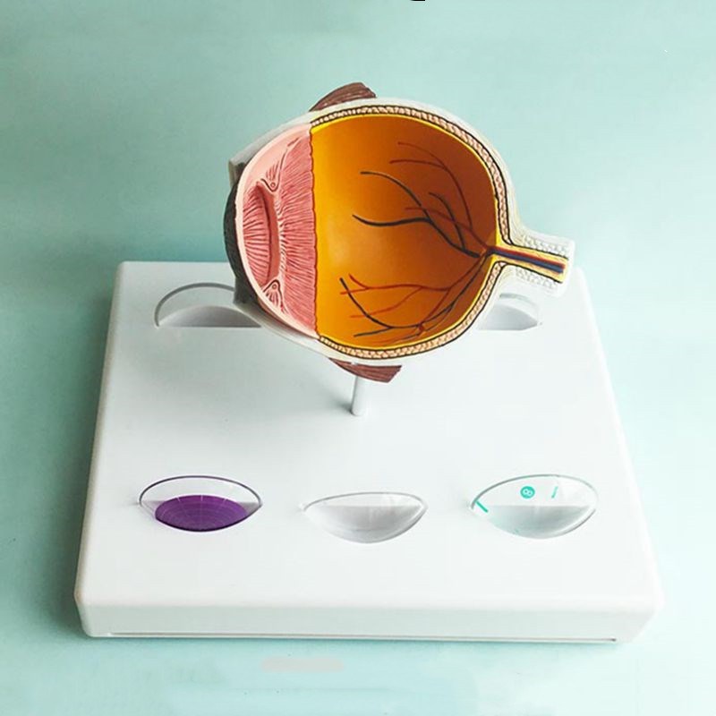 青光眼模型人体眼睛视力晶状体虹A膜眼底视网膜血管神经眼科教学