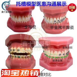 牙科正畸模型全口陶瓷金s属自锁红色正畸医患沟通矫正练习托槽