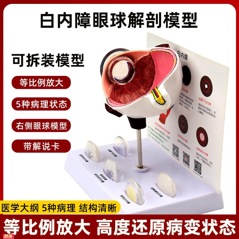 人体仿真眼睛眼球3d结构放大解剖模型白内障病理演示医学教学道具