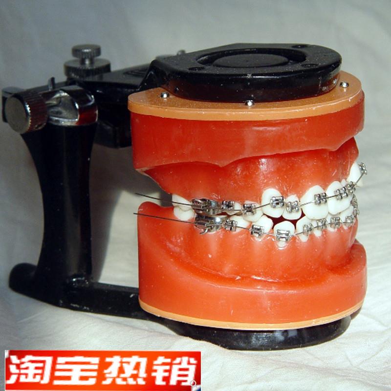 ENOVO颐诺正畸矫X正练习模型