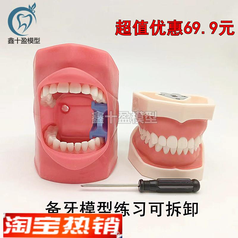 口腔备牙模型仿真牙齿模型练习备牙粒离L体牙口腔考试教学软牙龈