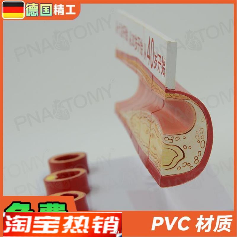 德国】人体血脂胆固醇与r年龄模型guan心病血栓过程模动脉医学