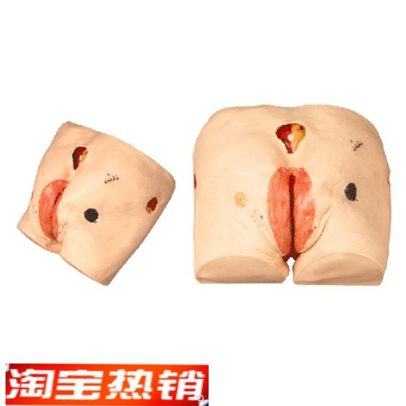 上海医模H17E高级压疮(褥疮)护理模型操作练习训练X医学教学臀部