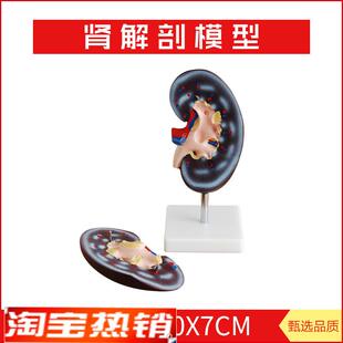 肾解剖模型2件右肾作t额状切面示肾门肾血管输尿管肾盂肾脏