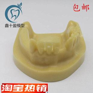 牙科材料下半口种植练习模型发泡缺失种植练习Q教学模型M2028