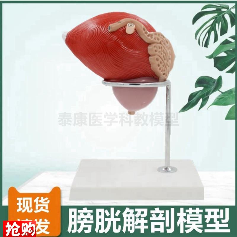 膀胱模型生殖泌尿器官前列腺健康B病变比较中老年人肾脏男科医患