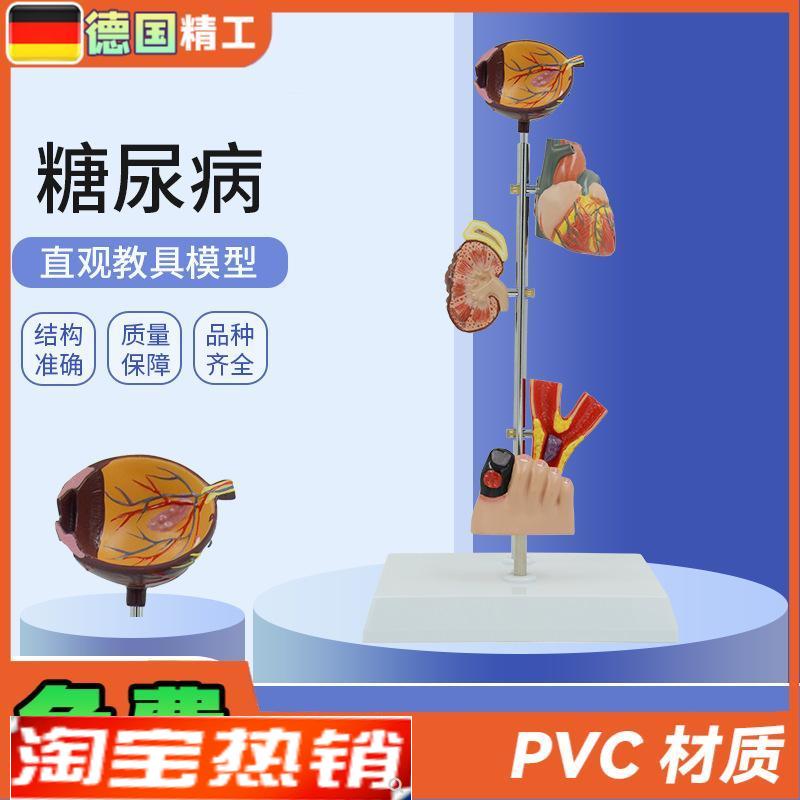 德国】人体医学糖尿并发症眼睛心脏肾脏血M管足内外科康复病理演