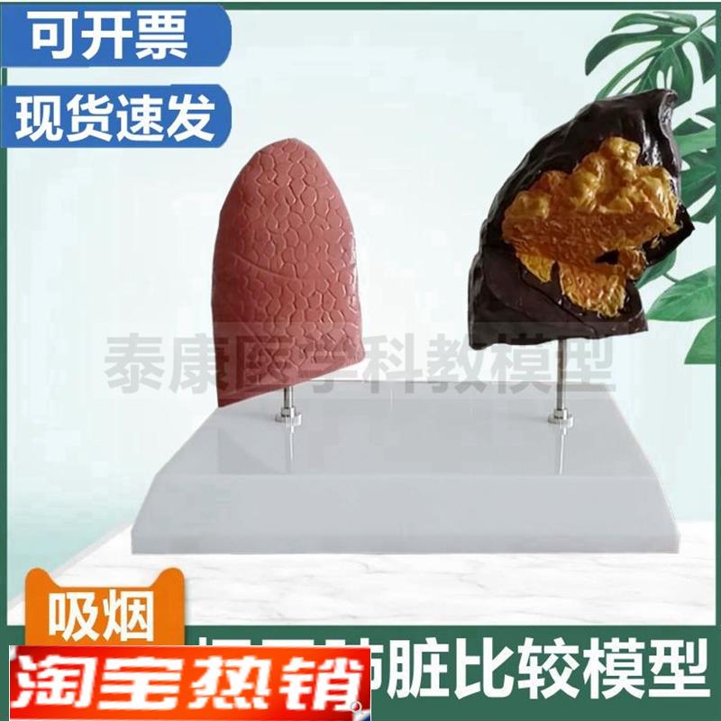 爱国卫生运动教育模型禁烟警示展示吸烟有害健康模型危Z害人体器