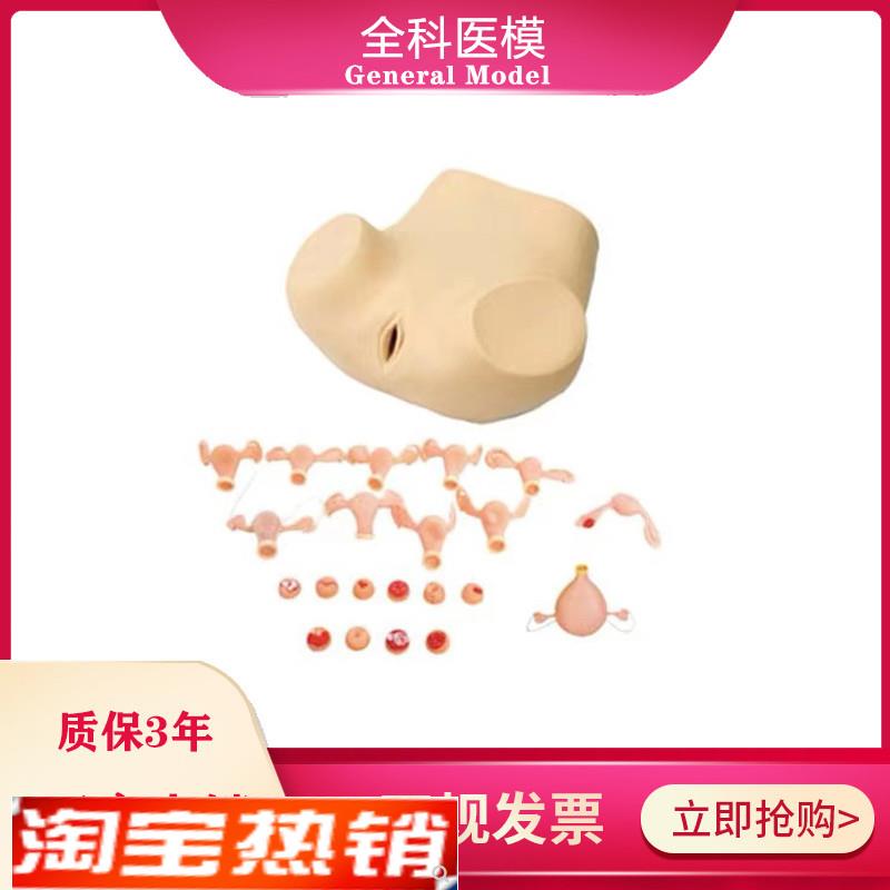 妇科检查训练模型脓肿积水宫颈炎白G斑息肉女性生殖器护理人模型